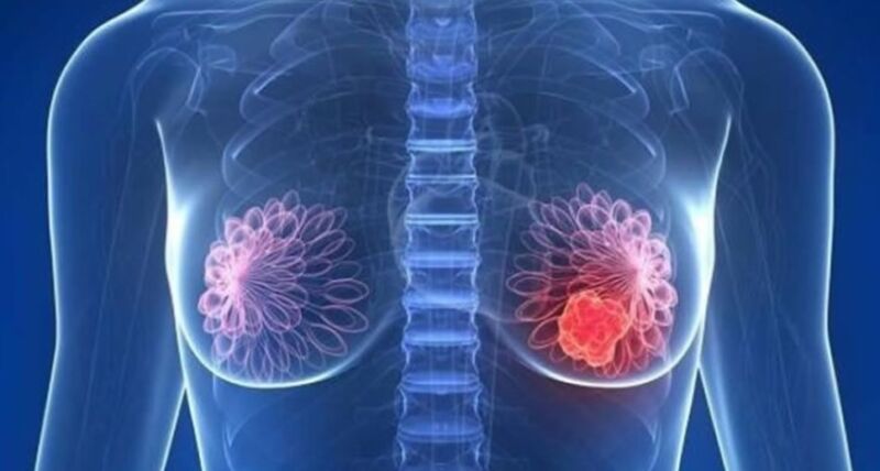 Misiones tendrá un programa