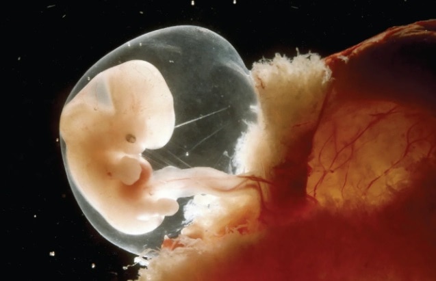 La placenta, uno de los