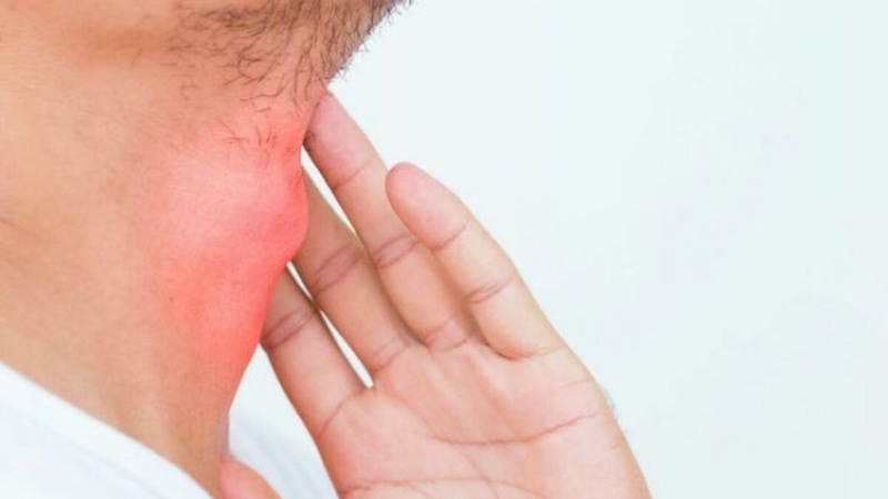 15 de septiembre: Día Mundial del Linfoma