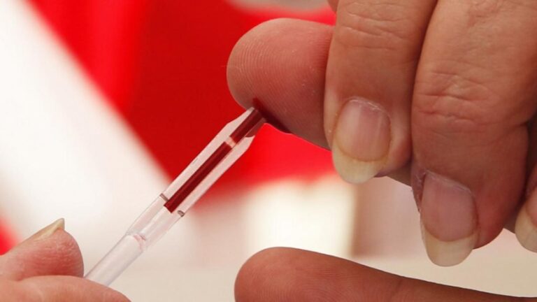 Realizarán testeos de VIH, Hepatitis B y Sífilis en la Escuela de Enfermería