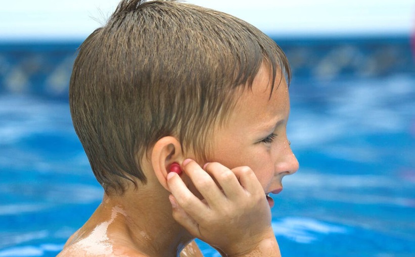 Otitis de verano