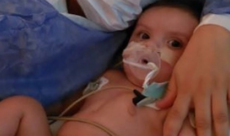 Triste noticia: falleció Catalina, la beba posadeña que padecía una cardiopatía congénita