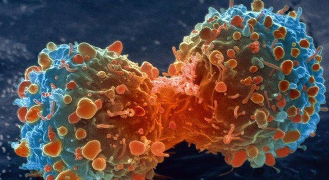 Desarrollan una batería implantable que ayuda a matar células tumorales