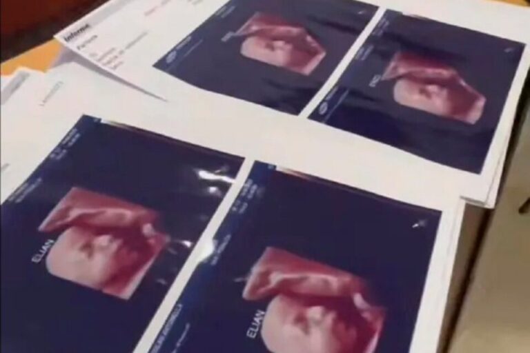 Aseguran que una clínica de Formosa usaba la foto de la misma ecografía para todas las embarazadas
