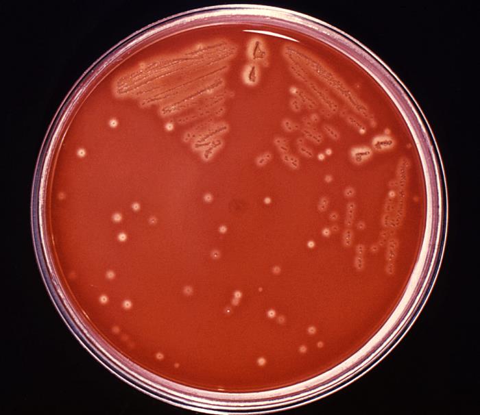 Streptococcus Pyogenes, la bacteria que ya causó la muerte de 16 personas
