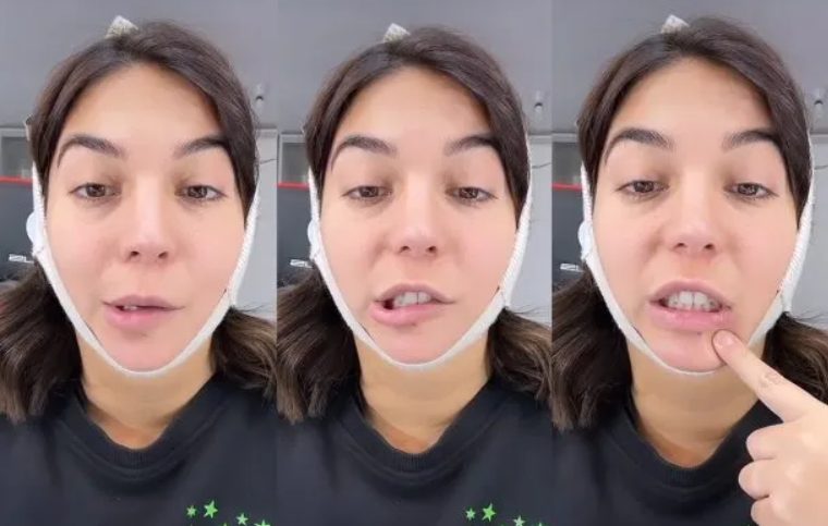 Luciana Milessi sufre secuelas por una cirugía estética y envió un mensaje a sus seguidores