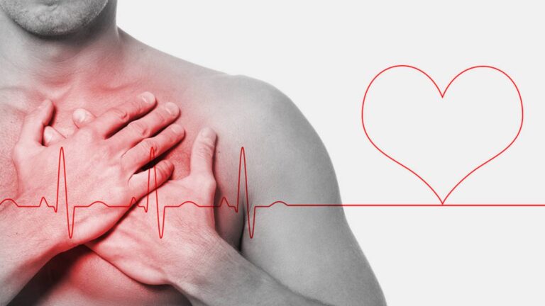 Cuáles son los síntomas que alertan un paro cardíaco