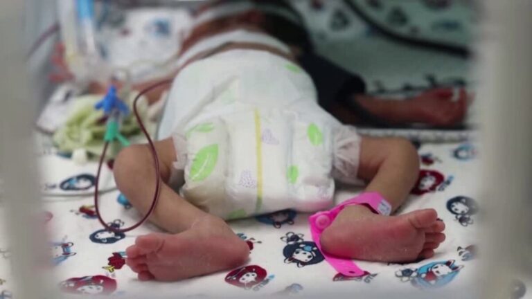 Gaza: médicos ayudaron a un bebé a nacer tras la muerte de su madre