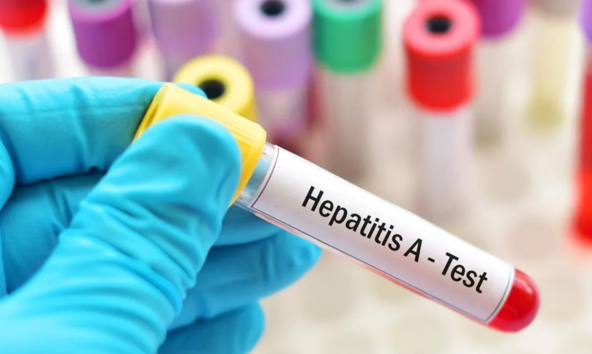 Hepatitis a