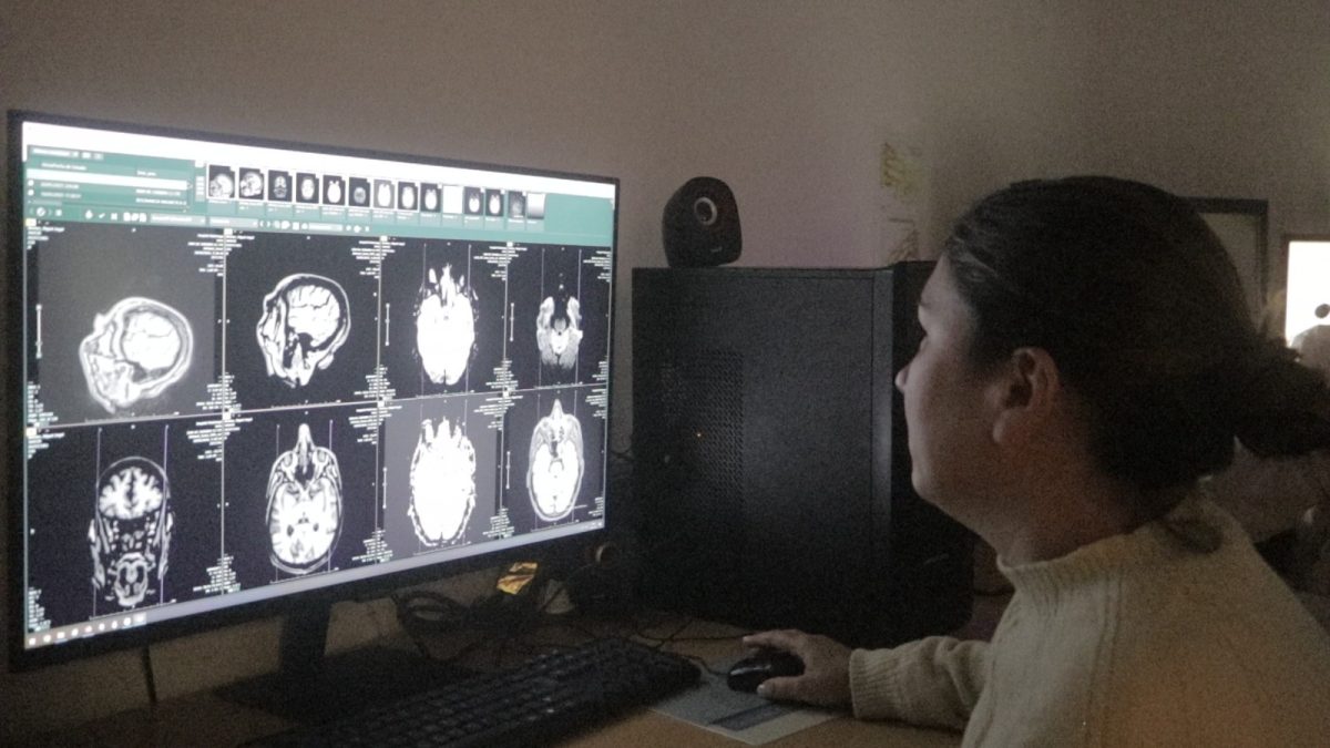 Salud Pública advirtió sobre los principales factores de riesgo del ACV