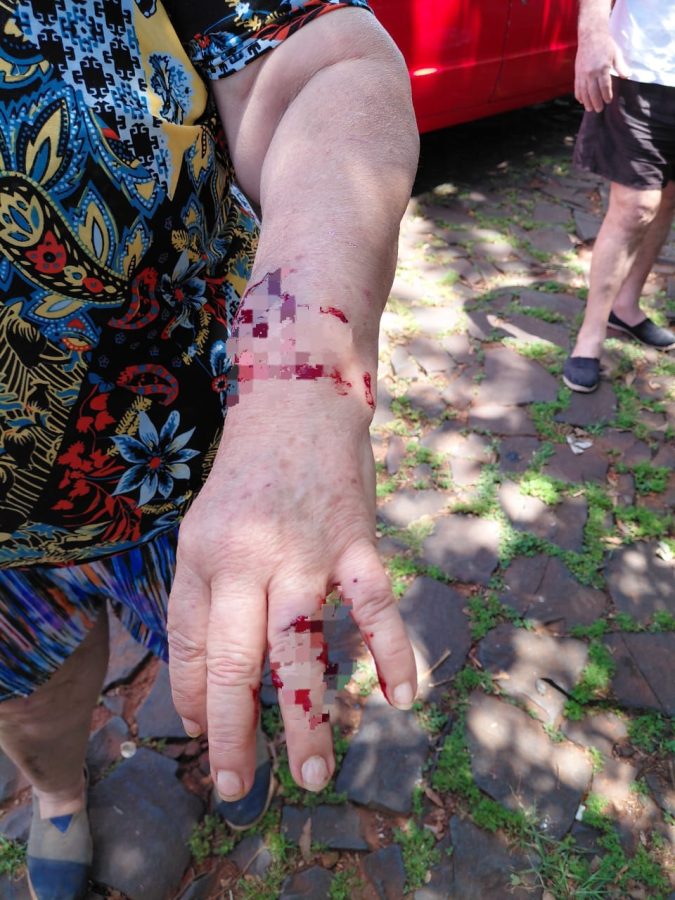 Dos mujeres fueron hospitalizadas tras ser atacadas por pitbulls en Posadas 1 2 - IMG 20251101 WA0001 - 1