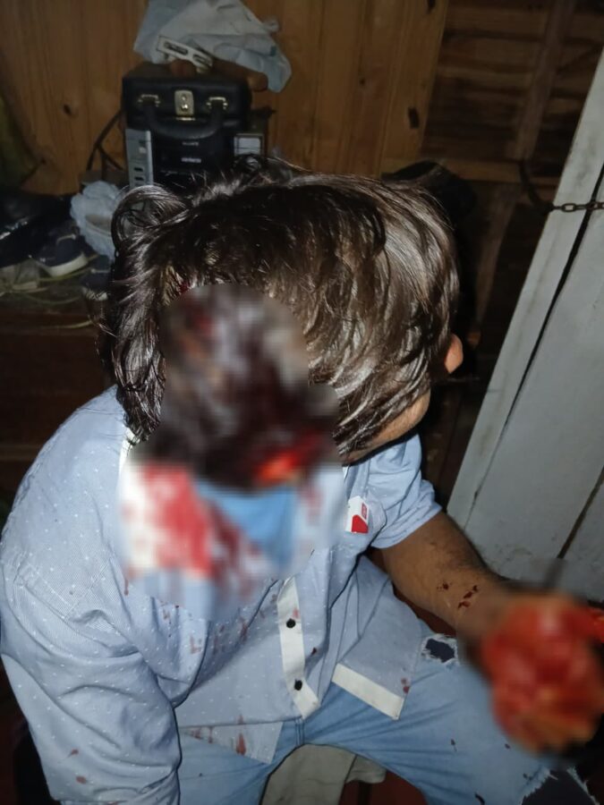 Vecinos atacaron y dejaron hospitalizado a un hombre en Posadas 1 - 1